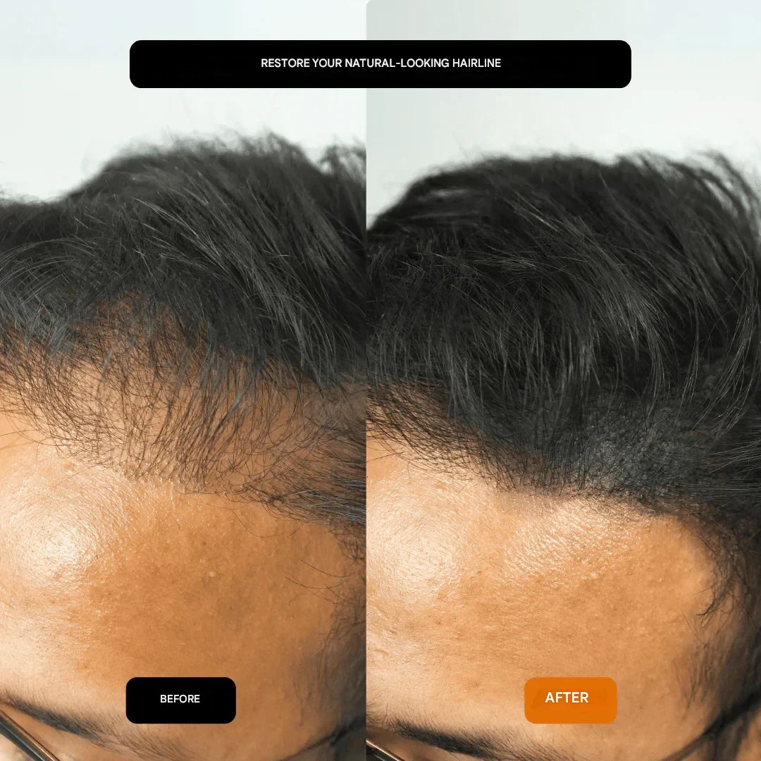 GROWY™ Hair Fiber Powder – Buy 1, Get 2