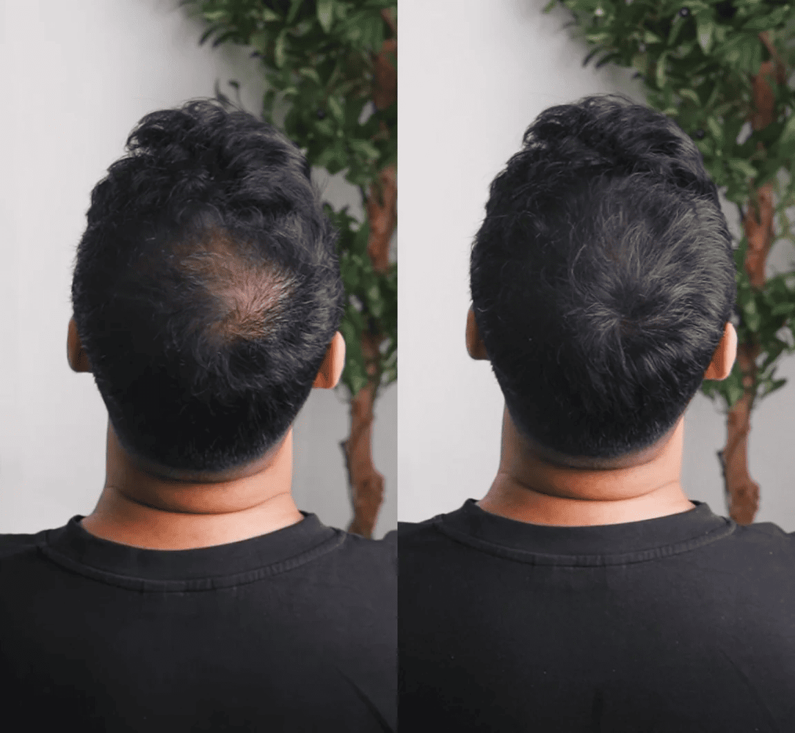 GROWY™ Hair Fiber Powder – Buy 1, Get 2