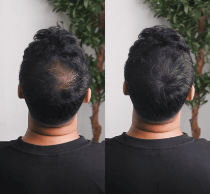 GROWY™ Hair Fiber Powder – Buy 1, Get 2