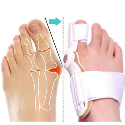 Unisex Rotating Toenail Corrector – Perfect Fit – Buy 1, Get 2